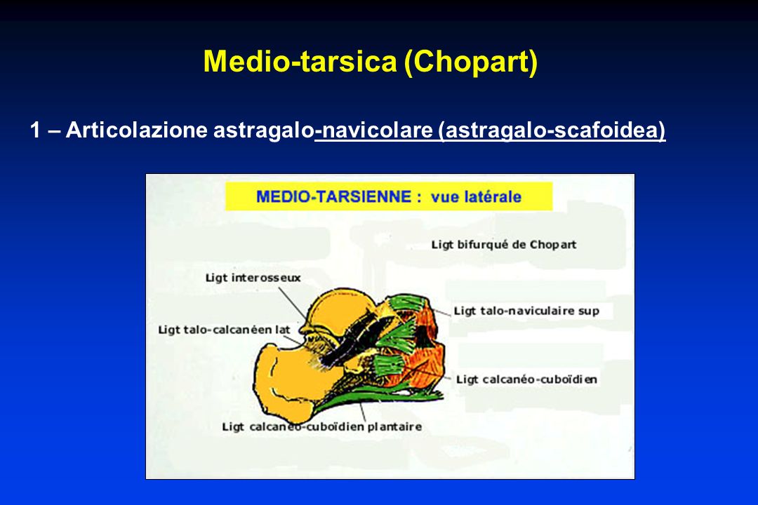 Lussazioni della caviglia e del retro piede ppt video online